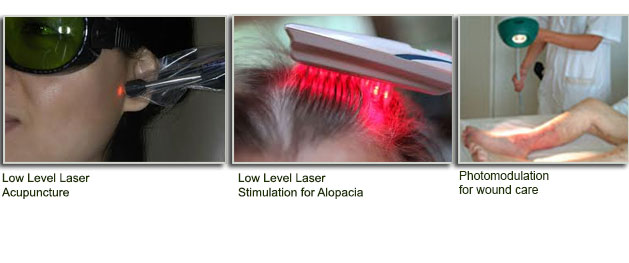 low-level-lasers