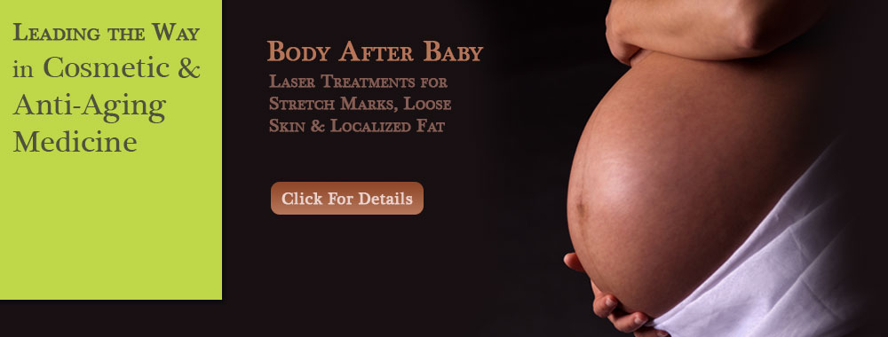 Body-After-Baby